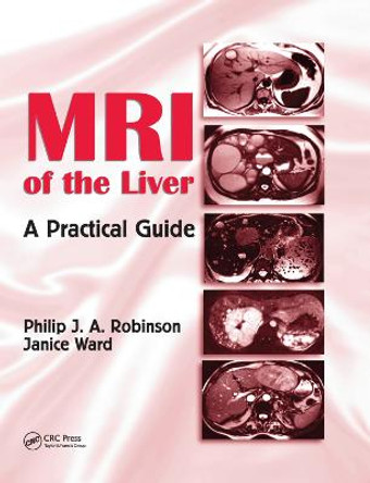 MRI of the Liver: A Practical Guide by Philip J. A. Robinson