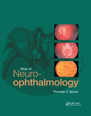 Atlas of Neuro-ophthalmology by Thomas C. Spoor