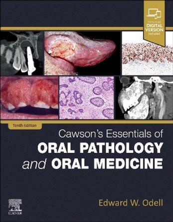 Cawson's Essentials of Oral Pathology and Oral Medicine by Edward W Odell 9780323935494