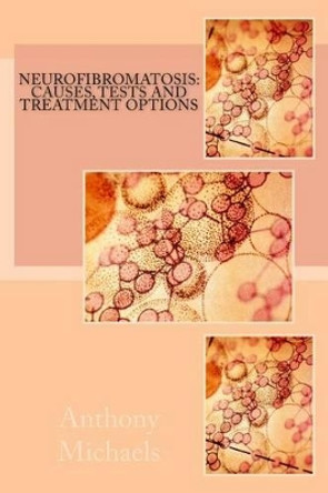 Neurofibromatosis: Causes, Tests and Treatment Options by Jennifer Grange MD 9781470125967