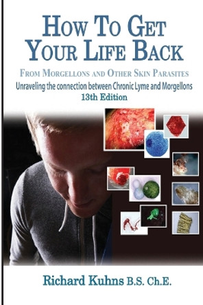 How to Get Your Life Back from Morgellons and Other Skin Parasites Limited Edit by MR Richard L Kuhns 9781475010527