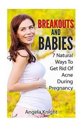 Breakouts And Babies: 7 Natural Ways To Get Rid Of Acne During Pregnancy by Angela Knight 9781491220054