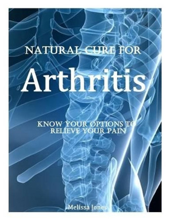 Natural Cure for Arthritis: Know Your Options to Relieve Your Pain by Melissa Jones 9781495210785