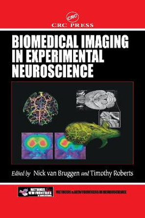 Biomedical Imaging in Experimental Neuroscience by Nick Van Bruggen