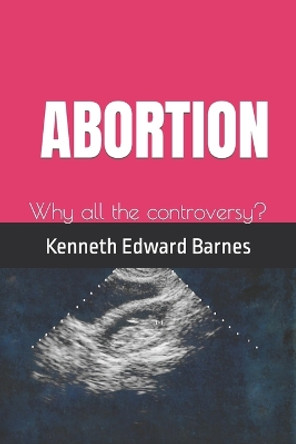 Abortion: Why all the controversy? by Kenneth Edward Barnes 9781521549315