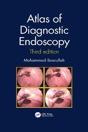 Atlas of Diagnostic Endoscopy, 3E by Mohammad Ibrarullah