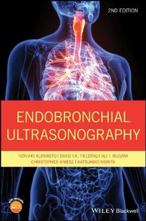 Endobronchial Ultrasonography by Noriaki Kurimoto
