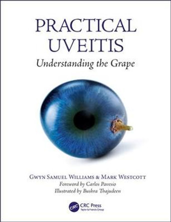 Practical Uveitis: Understanding the Grape by Gwyn Samuel Williams