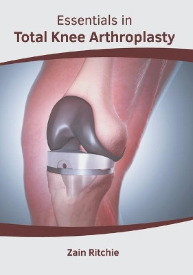 Essentials in Total Knee Arthroplasty by Zain Ritchie 9781646461462