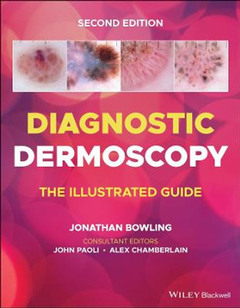 Diagnostic Dermoscopy - The Illustrated Guide by Jonathan Bowling