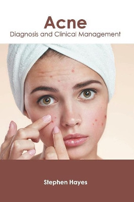 Acne: Diagnosis and Clinical Management by Stephen Hayes 9781632426178