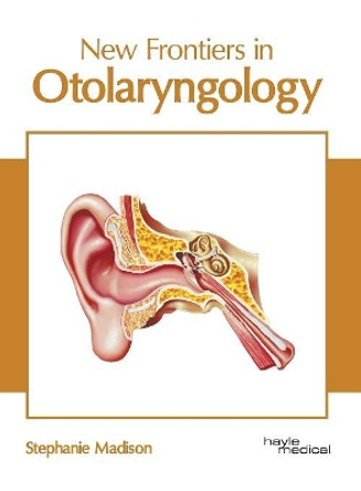New Frontiers in Otolaryngology by Stephanie Madison 9781632417251