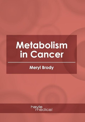 Metabolism in Cancer by Meryl Brody 9781632418371