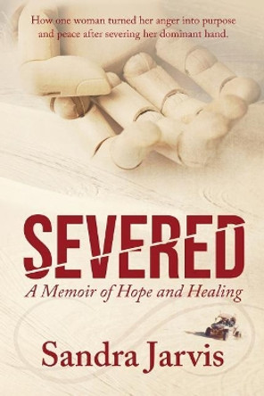 Severed: A Memoir of Hope and Healing by Sandra Jarvis 9781733963206