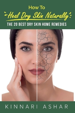 How to Heal Dry Skin Naturally: The 20 Best Dry Skin Home Remedies by Kinnari Ashar 9781922649805 How to Heal Dry Skin Naturally: The 20 Best Dry Skin Home Remedies by Kinnari Ashar 9781922649805