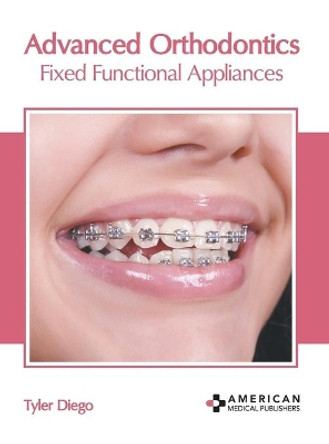 Advanced Orthodontics: Fixed Functional Appliances by Tyler Diego 9781639270507