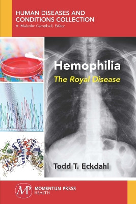 Hemophilia: The Royal Disease by Todd Eckdahl 9781944749637
