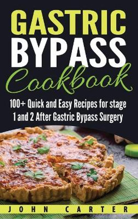 Gastric Bypass Cookbook: 100+ Quick and Easy Recipes for stage 1 and 2 After Gastric Bypass Surgery by John Carter 9781951404383