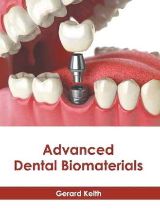 Advanced Dental Biomaterials by Gerard Keith 9781639270491
