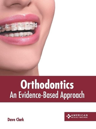 Orthodontics: An Evidence-Based Approach by Dave Clark 9781639270590