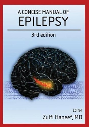 A concise manual of epilepsy: 3rd edition by Zulfi Haneef 9781540752611