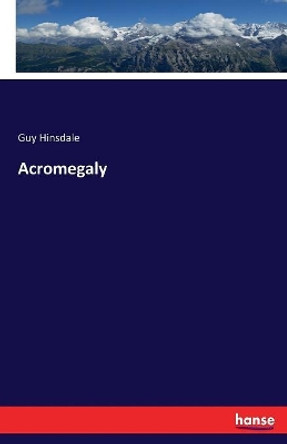 Acromegaly by Guy Hinsdale 9783337379827