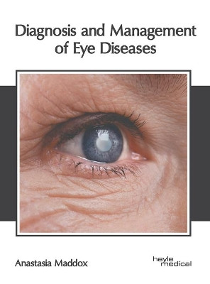 Diagnosis and Management of Eye Diseases by Anastasia Maddox 9781632418968