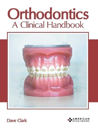 Orthodontics: A Clinical Handbook by Dave Clark 9781639270583