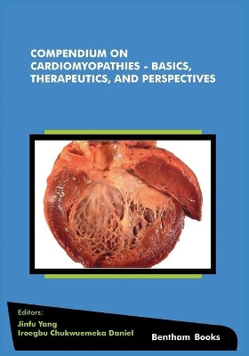 Compendium on Cardiomyopathies - Basics, Therapeutics, and Perspectives by Iroegbu Chukwuemeka Daniel 9789811432330