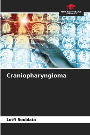 Craniopharyngioma by Lotfi Boublata 9786205913482