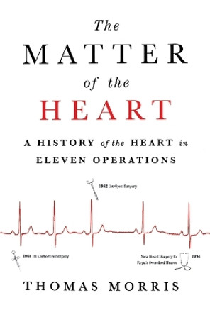 Matter of the Heart by Thomas Morris 9781250890016