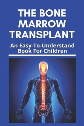 The Bone Marrow Transplant: An Easy-To-Understand Book For Children: Bone Marrow Transplant Risks by Kay Millbern 9798730520615