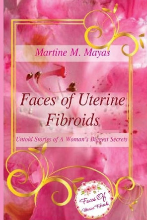 Faces of Uterine Fibroids: Untold Stories of A Woman's Biggest Secrets by Martine M Mayas 9781547016266
