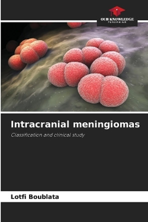 Intracranial meningiomas by Lotfi Boublata 9786206050407