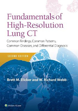 Fundamentals of High-Resolution Lung CT: Common Findings, Common Patterns, Common Diseases and Differential Diagnosis by Brett M Elicker