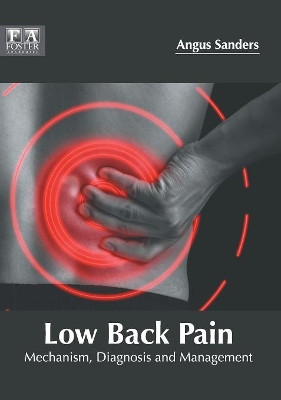Low Back Pain: Mechanism, Diagnosis and Management by Angus Sanders 9781632425546