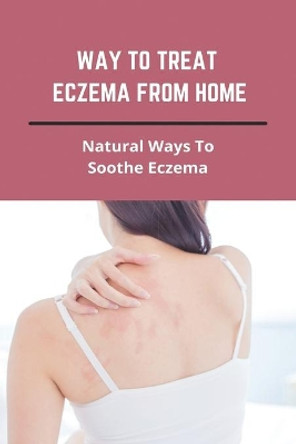 Way To Treat Eczema From Home: Natural Ways To Soothe Eczema: How To Treat Eczema Through Diet by Carolann Guillot 9798740569406