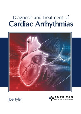 Diagnosis and Treatment of Cardiac Arrhythmias by Joe Tyler 9798887400570