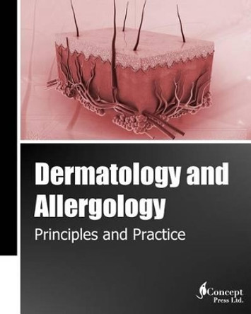 Dermatology and Allergology: Principles and Practice (Black and White) by Iconcept Press 9781922227959