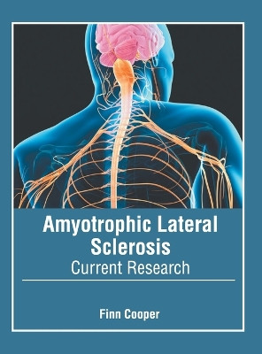 Amyotrophic Lateral Sclerosis: Current Research by Finn Cooper 9781639870448
