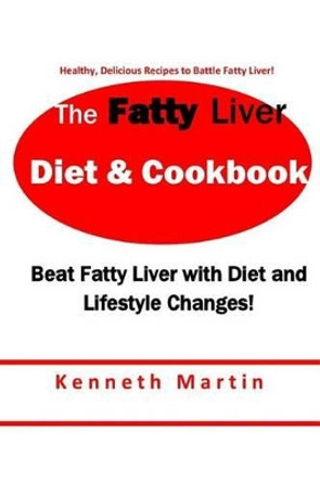 The Fatty Liver Diet & Cookbook: Beat Fatty Liver with Diet & Lifestyle Changes by Kenneth Martin 9781540830302