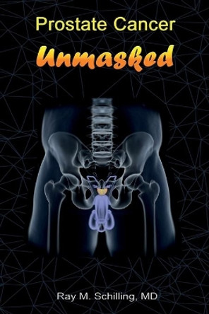 Prostate Cancer Unmasked by Ray M Schilling 9781542880664