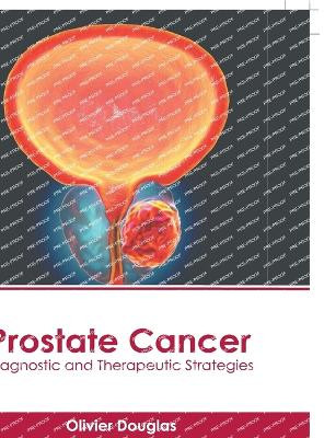 Prostate Cancer: Diagnostic and Therapeutic Strategies by Olivier Douglas 9781646466320
