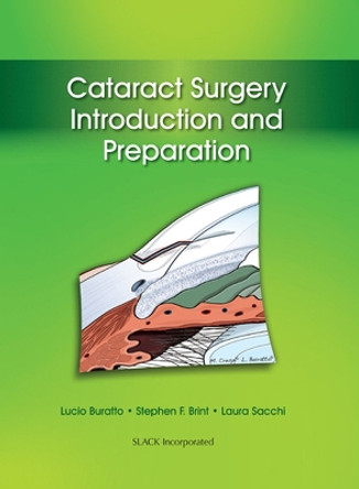 Cataract Surgery: Introduction and Preparation by Lucio Buratto 9781617116056