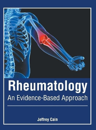 Rheumatology: An Evidence-Based Approach by Jeffrey Cain 9781632428530