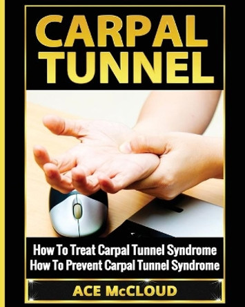 Carpal Tunnel: How To Treat Carpal Tunnel Syndrome: How To Prevent Carpal Tunnel Syndrome by Ace McCloud 9781640480094
