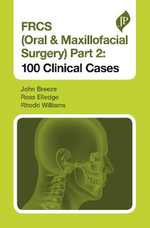 FRCS (Oral & Maxillofacial Surgery) Part 2: 100 Clinical Cases by John Breeze