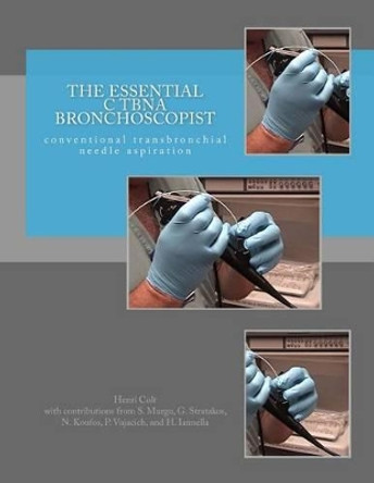 The Essential cTBNA Bronchoscopist: conventional TransBronchial Needle Aspiration by Septimiu Murgu 9781517342692