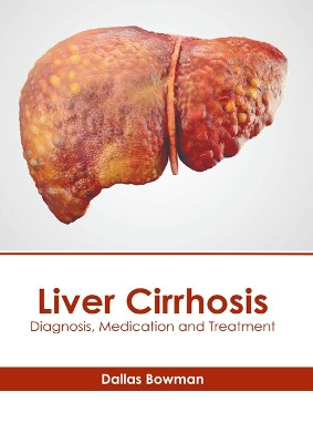 Liver Cirrhosis: Diagnosis, Medication and Treatment by Dallas Bowman 9798887402314