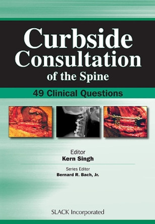 Curbside Consultation of the Spine: 49 Clinical Questions by Kern Singh 9781556428234